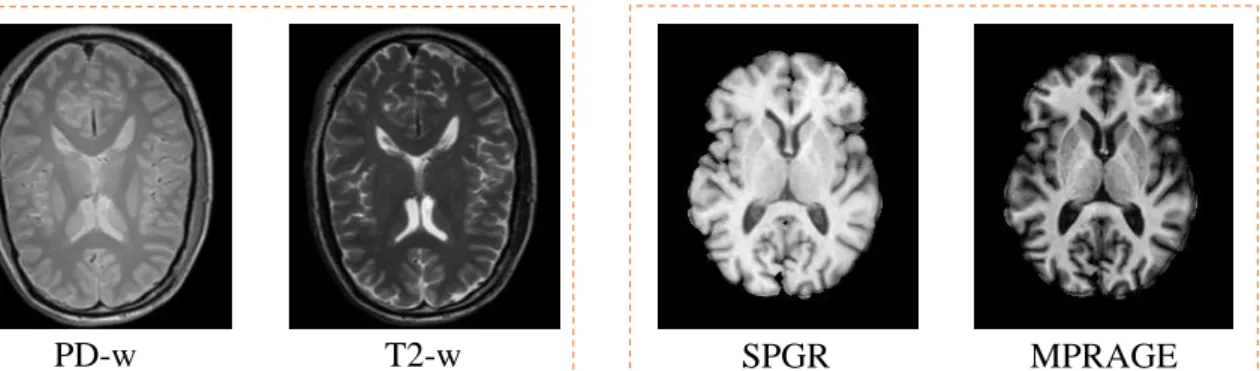 Fig. 1.1 Example of different imaging modalities - PD-w, T2-w, SPGR and MPRAGE images.