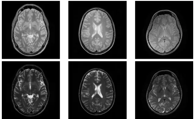 Fig. 1.5 Illustration of the example PD-w and T2-w MR images from the IXI dataset. In each panel, the first row shows the PD-w image while the second row shows the corresponding T2-w data.