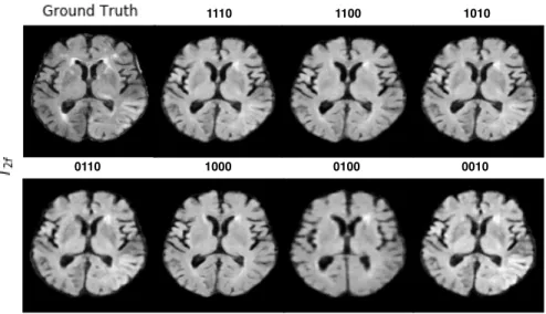 Figure 3.2: Qualitative results from T 2f lair synthesis experiments with ISLES2015 dataset.