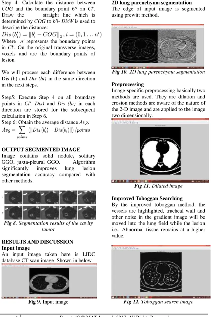 Fig 8. Segmentation results of the cavity  tumor 