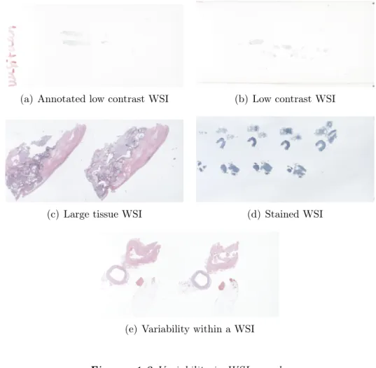 Figure 1.3 Variability in WSI samples