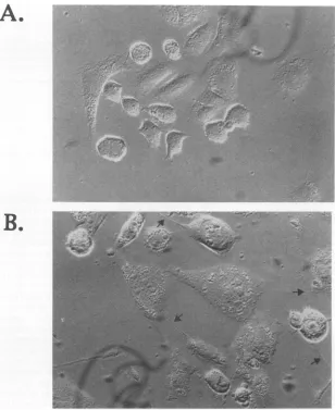 FIG. 5.(B) Morphological changes in NB41A3 cells following incubation in isoleucine-free medium