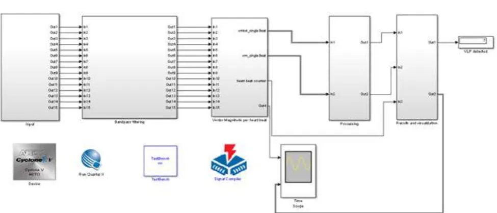 Figure 2: Simulink model of the detection algorithm 