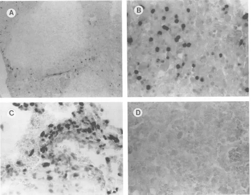 FIG. 4.lymphocytesBiopsylymphocytespanel Detection of HIV-1 DNA in brain biopsy samples by tissue-based PCR-driven in situ hybridization