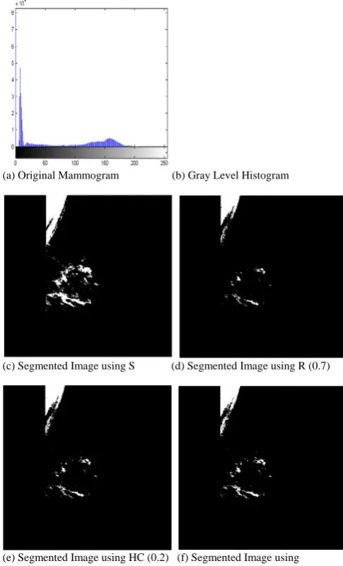 Fig. 3. (a) Fatty  mammogram (mdb238) of mini-MIAS database, (b) its gray level histogram, and (c), (d), (e) and (f) segmented images using Renyi entropy (07.), Havrda &Charvat entropy (2.0) and Kapur entropy (,5.07.0) based techniques respectively 