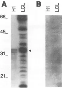 FIG. 8.withfrompoly(G)-agarosecellulosetantsEBNA-2B,EBNA-2BJABonSDS-PAGE, 10% Binding of wt EBNA 2 or E2d337-354 to nucleic acids