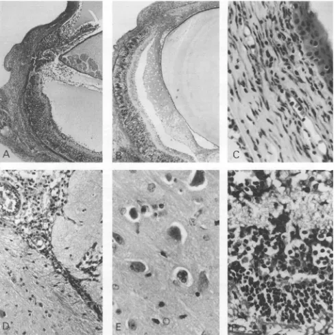 FIG.1.tissuesderived,subretinalofmousemononuclear(D)inflammatoryx48. the Virus-induced pathology in eyes and brains of 5- to 6-week-old mice by day 6 after inoculation of HSV-1