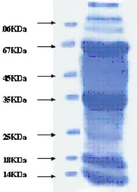 Fig. 1: Show SDS page pattern of liverhomogenate (volume loaded 30µl)