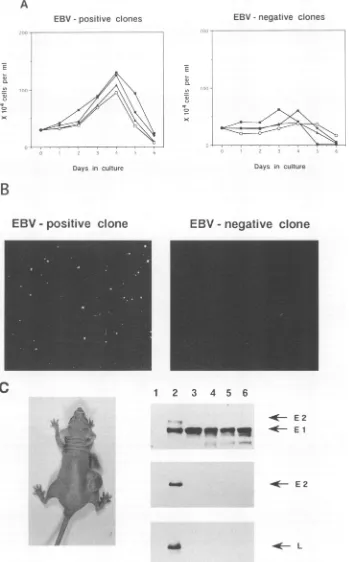 FIG. 2.clones2,inEBNA219-19 BJAB-B95-8 soft Growth characteristics of EBV-positive and EBV-negative Akata cell clones
