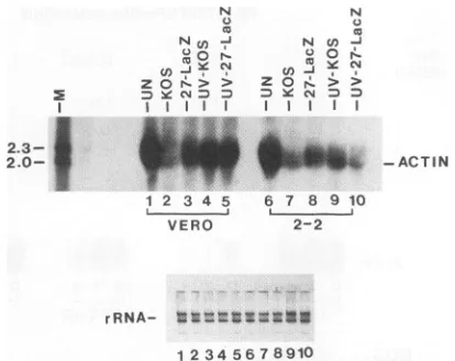 Fig. 4 that equivalent amounts of RNA were recovered andanalyzed from each transfection, since equivalent amounts of1-actin RNA were seen when portions of the RNA samples