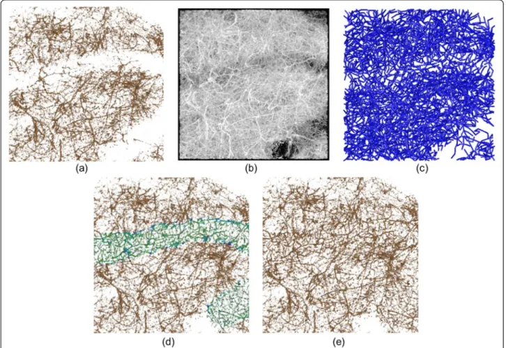 Figure 8 Apical dendric region represented using (a) TF preset visualization, (b) MIP-based DVR, (c) surface reconstruction by neuron tracing, (d) TF shift applied to the low contrast area locally and interactively and (e) the improved DVR result, which cl