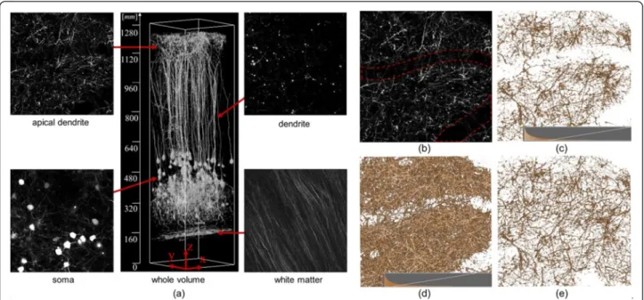 Figure 1 shows slice images that include structures with characteristic shapes measured from a live mouse using a two-photon microscope