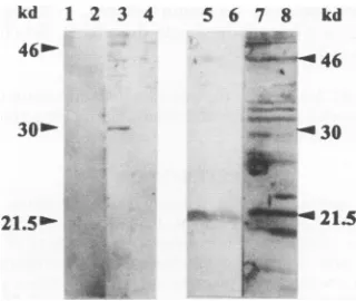 FIG. 4.vivo.withantiserumantisera,BSC1theproteinspQE32-transformedandtively:of molecular The PVM P-gene second ORF encodes a polypeptide in Shown is a Western blot of a polyacrylamide gel probed with raised against a peptide based on the predicted sequence