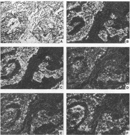 FIG. 8.aftera sense-oriented In situ hybridization of a poorly differentiated domestic rabbit carcinoma (Fig