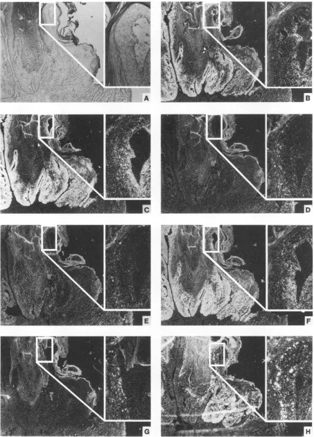 FIG. 5.dysplasticpapillomateoushybridizationdark-field In situ hybridization of adjacent tissue sections of a progressing domestic rabbit papilloma (Fig