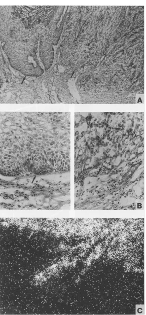FIG.cepitheliumhybridizing 6. (A) Histopathology of a progressing domestic rabbit papilloma (Fig