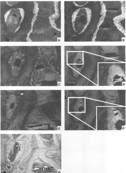 FIG. 7.hybridizationmicroscopy In situ hybridization of a well-differentiated domestic rabbit carcinoma (Fig
