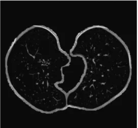 Fig. 5. Example of an including matrix resulted from region growing (a slice).