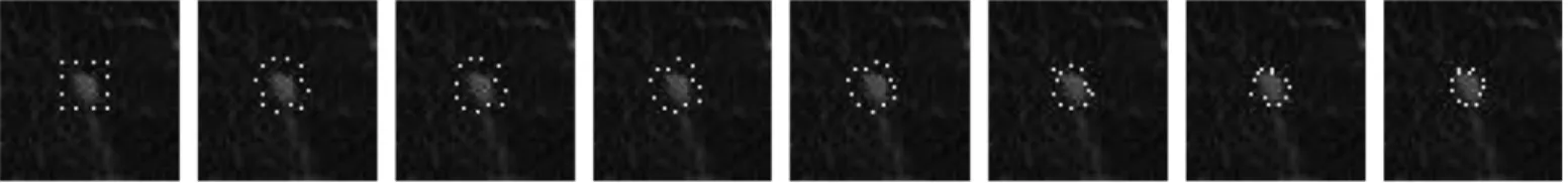 Fig. 12. Sample of MSMs analysis on a juxtapleural nodule: visualization of the evolution on a central slice with cubic initialization.