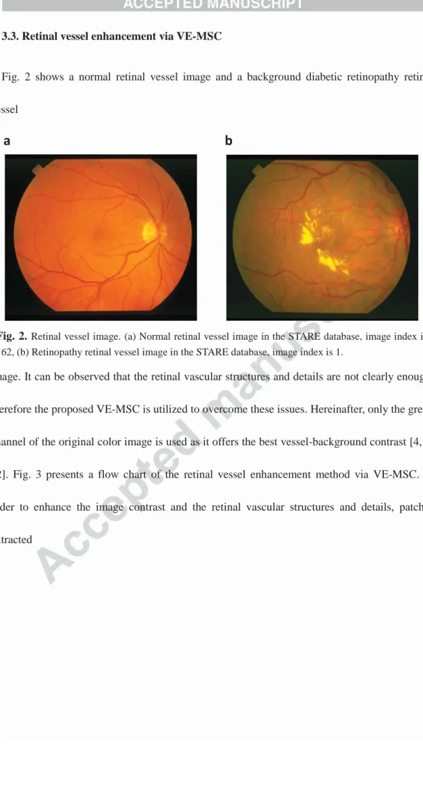 Fig. 2 shows a normal retinal vessel image and a background diabetic retinopathy retinal 