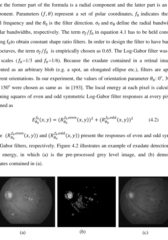 Figure  4.2  Local  energy  example  of  detecting  exudate.  (a)  is  the  pre-processed  grey  level  image,  and  (b)  demonstrates  exudates  contained  in  (a);  (c)  is  the  result  image  where  the  exudates are removed