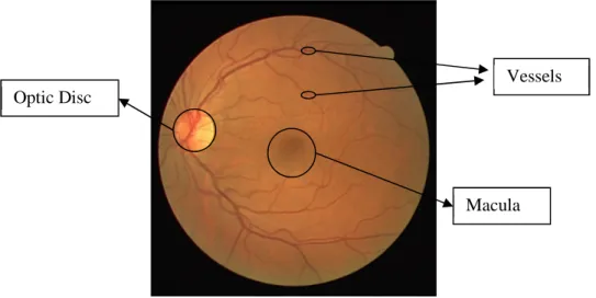 Figure 1.6 An example retinal image (fundus photography) showing anatomic structures. 