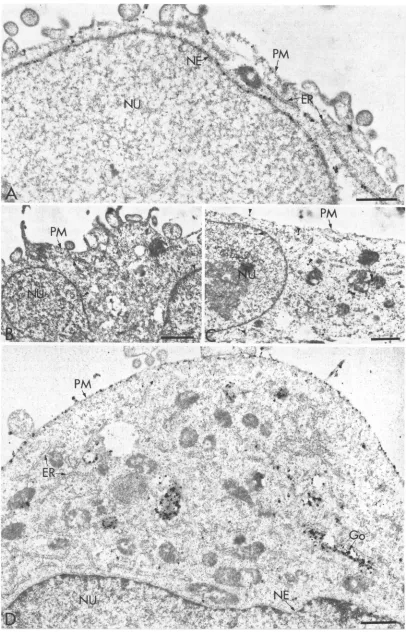 FIG. 5.processedpanels Glycoprotein gB but not G is localized in the NE. COS-1 cells transfected with gB (A and C) or with G (D) or not transfected (B) were for electron microscopy and labeled with anti-gB (A and B) or anti-G (C and D) antibodies as descri