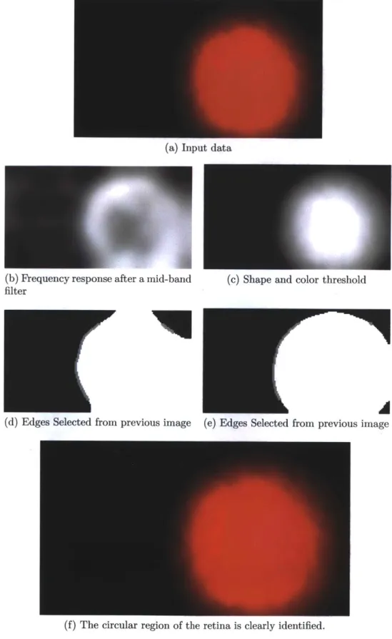 Figure  3-7:  Finding  the  retinal  region.  Left  column:  Frequency  filtered  selection.