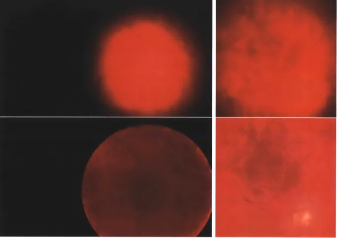 Figure  3-8:  Two examples  of retinal  vignetting  correction.  The top  images  show  the original  image  before  vignetting  correction  and  the  bottom  images  show  the  change after  the  image  has  been  corrected