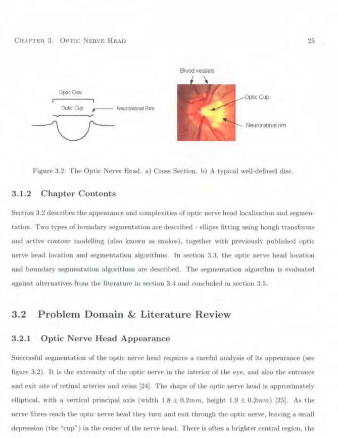 Figure  3.2:  The Optic Nerve  Head .  a)  Cross Section.  b)  A  typical  well-defined  disc 