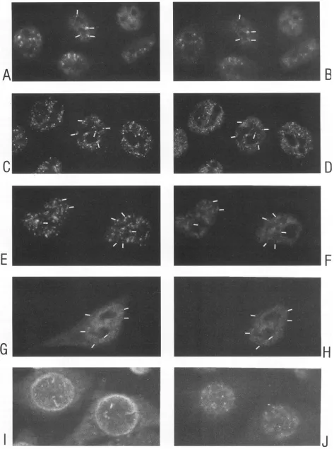 FIG. 3.characterizationlabelinganti-human Characterization of the human sm-positive serum (Chemicon) in panels B, D, F, H, and J, using indirect immunofluorescent double of HeLa/crev cells with MAbs Y12 (A), 4B10 (C), 4F4 (E), La1B5 (G), and MAb350 (I)