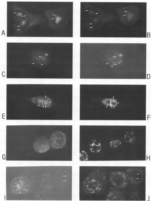 FIG. 4.anti-Rev8E7 Indirect immunofluorescent double labeling of HeLa/crev cells. All cells in panels A, C, E, G, and I were labeled with a polyclonal rabbit serum and a Texas red anti-rabbit conjugate