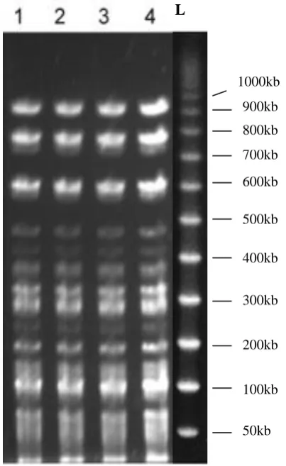 Figure 2. The isolate from the index case was a blood isolate shown in lane 1 while the subsequent isolates from the ETT secretions of the 3 other patients are 