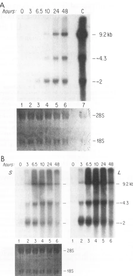 FIG.1.waswithwereACH-2containpreviouslycellspoints,cellularsameproductivelyconfirmed28S Changes in the pattern of RNA expression in UI (A) and (B) cells on PMA induction