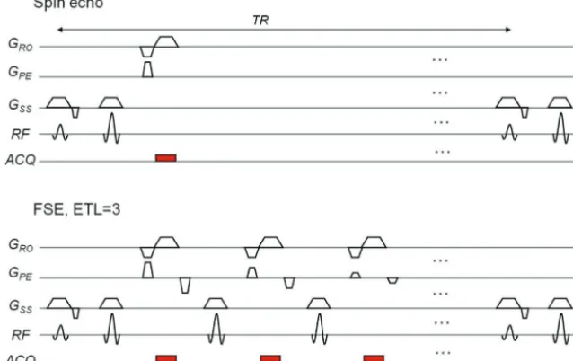 FIG 9. A sequence diagram for a spin-echo (top) and fast spin-echo sequence with an echo-train length or number of refocusing 180° pulses of3 (bottom), which signiﬁcantly decreases scanning time from 2-and-a-half minutes to 1 minute