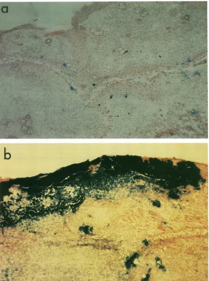 FIG. 2.pinnae Histological demonstration of cells infected with HSV-1 lacZ insertional mutants in mice (magnification, x 160)