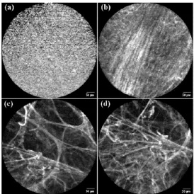 Fig. 1. Example pulmonary OEM images containing (a) pure noise due to loss of contact with  tissue, (b) low contrast and mostly linear bronchus strands, (c-d) alveoli elastin strands, healthy  and pathological respectively