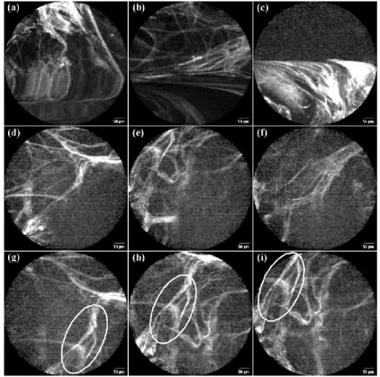 Fig. 2. Example frame sequences of (a-c) motion-artefacts as deformed structures, (d-f) motion- motion-artefacts as spatial discontinuity in temporally adjacent frames, and (g-i) large movements