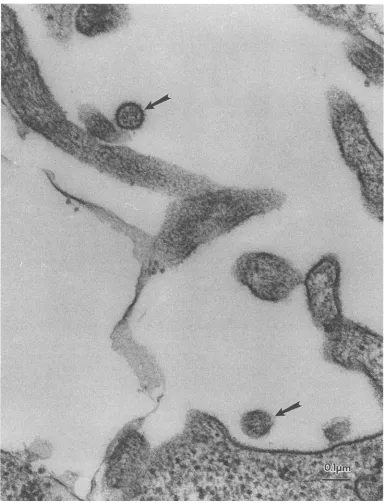 FIG. 5. Electron micrograph of BJAB cells cocultivated with lymphocytes from an STLV-II-infected spider monkey (SM-3)