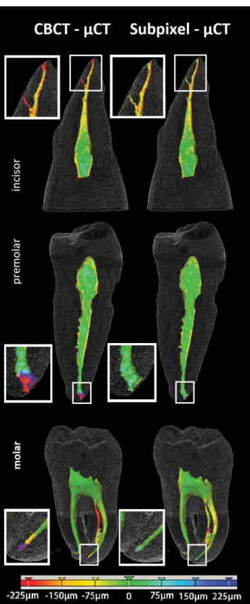 Fig. 7. Volumetric segmentation of the root canal on the test set (an upper incisor, a lower premolar tooth, and a lower molar)