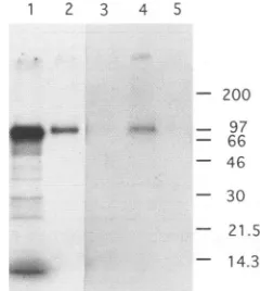 FIG. 2.cell-freespecificmonoclonaltranslationformedhyperimmunehyperimmuneanalyzedLaneI ORF-3