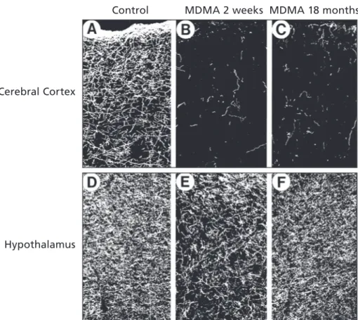 Figure 4.2: Photographs of serotonin axons in the cerebral cortex of nonhuman  primates labeled with a fluorescent marker