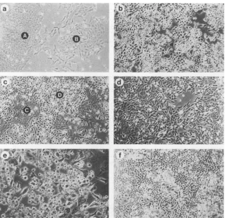 FIG.1.microscopeline(in Changes in cell morphology upon continued passage in culture. (a) Cell line H271 at an early (A) or intermediate (B) stage; (b) cell H271 at a late stage