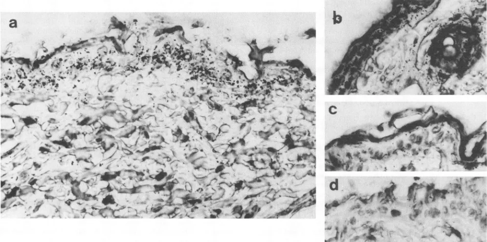FIG.1.exposurehybridizedacetoneMagnification,(b) In situ hybridization showing TPA-induced VL30 expression localized to epidermis and hair follicles