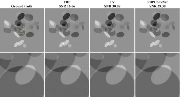 Fig. 3. Reconstructed images of ellipsoidal dataset from 143 views using FBP, TV regularized convex optimization [14], and the FBPConvNet