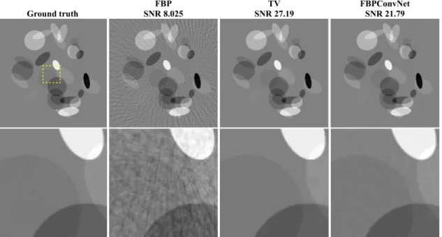 Fig. 4. Reconstructed images of ellipsoidal dataset from 50 views using FBP, TV regularized convex optimization [14], and the FBPConvNet.