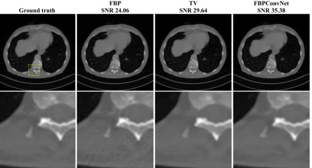 Fig. 5. Reconstructed images of biomedical dataset from 143 views using FBP, TV regularized convex optimization [14], and the FBPConvNet.