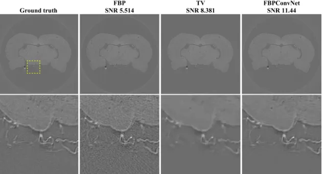 Fig. 7. Reconstructed images of experimental dataset from 145 views using FBP, TV regularized convex optimization [14], and the FBPConvNet.
