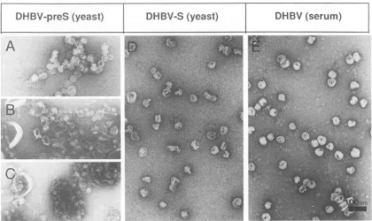 FIG. 3.corresponding(A)Preparations Electron microscopy of DHBV pre-S and S protein preparations from yeast cells in comparison with serum-derived DHBV particles