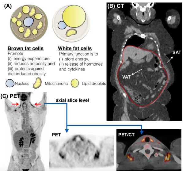 Figure 1.2: An illustration of different types of adipose tissues in Positron Emission Tomography (PET) and Computed Tomography (CT) scans